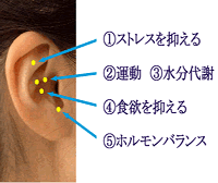 耳ツボ施術